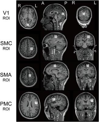 GABA Concentration in the Left Ventral Premotor Cortex Associates With Sensory Hyper-Responsiveness in Autism Spectrum Disorders Without Intellectual Disability